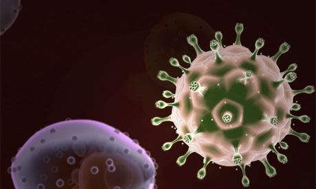 艾滋病进入人体攻击免疫细胞
