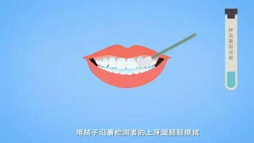 艾滋病唾液试纸使用第二步：擦拭牙龈。