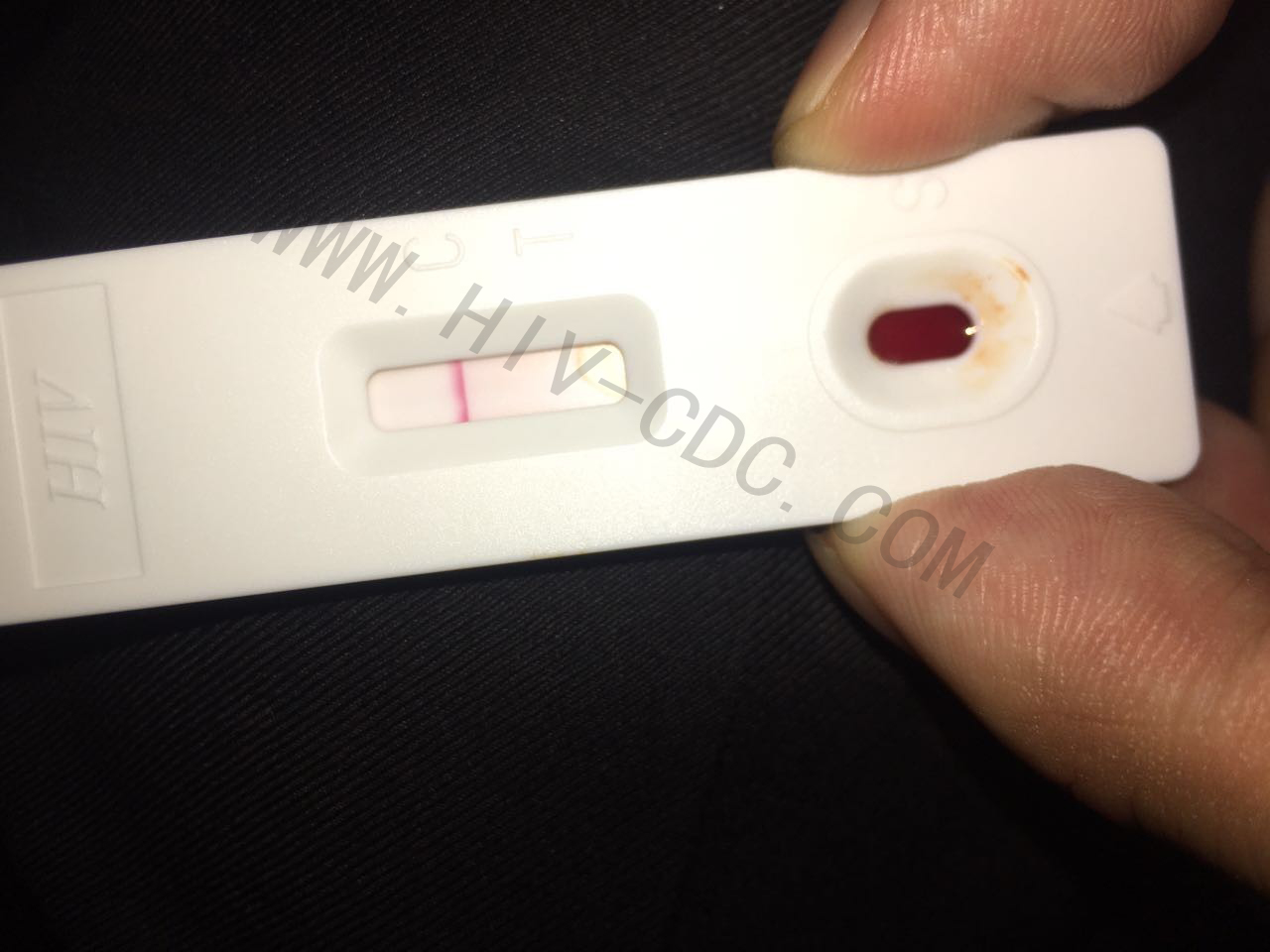 用hiv检测试纸检测艾滋病的方法步骤