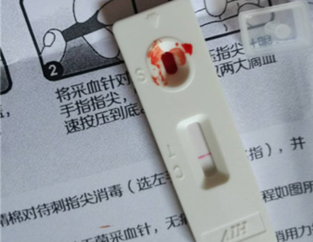 艾滋病血液检测试纸