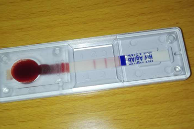 艾滋病检测试纸一次性采血针干净