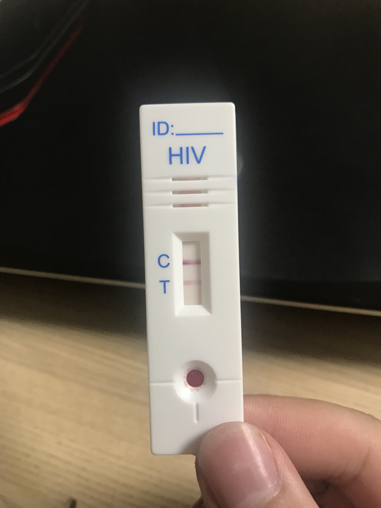 艾滋病检测试纸准确