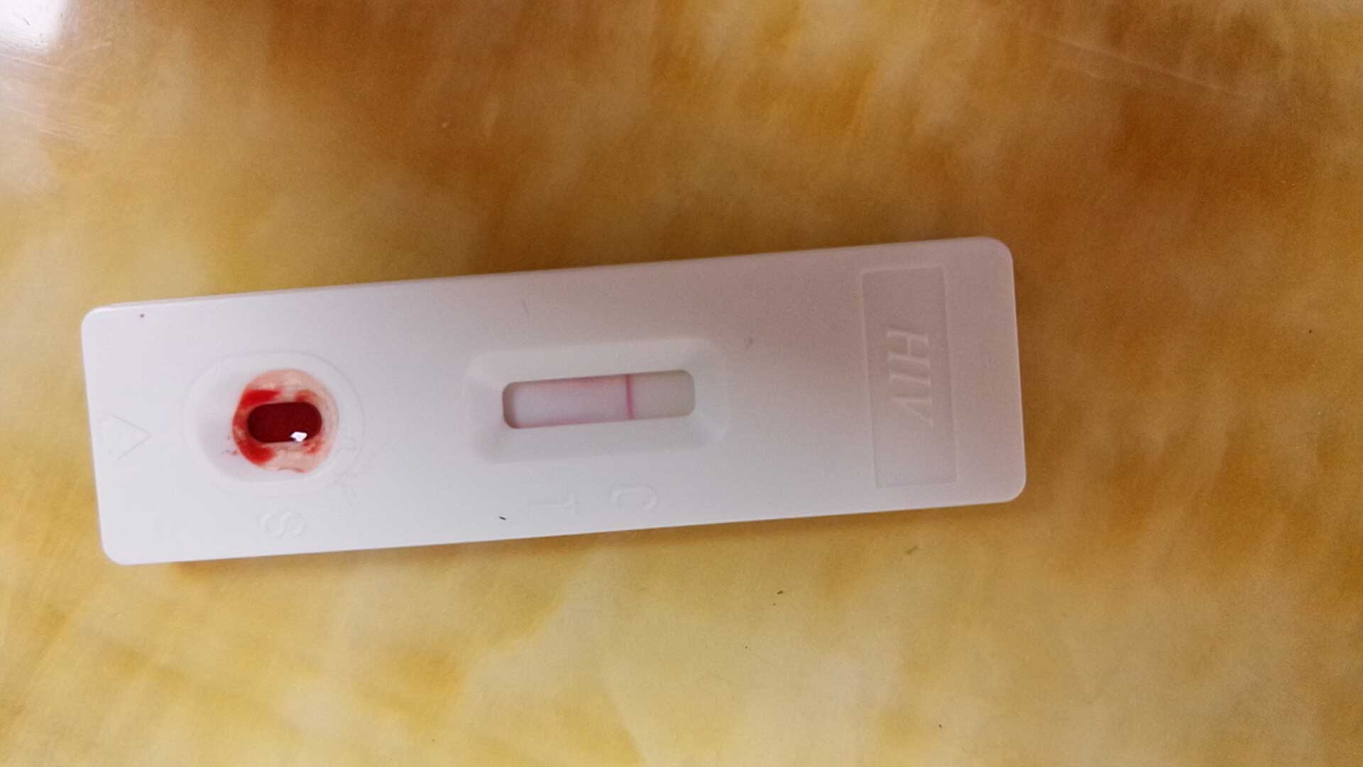 艾滋病试纸阴性没事吧：第三个月检测为阴性可以基本排除感染艾滋病的可能。