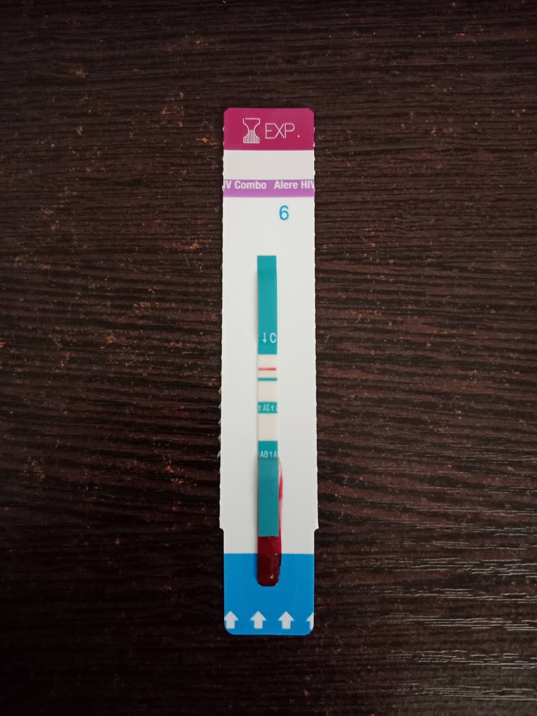 艾滋病试纸阴性正常吗：高危行为后的3-6个月是很准确的