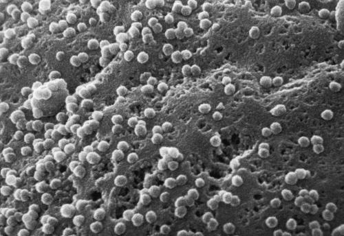 从Ｔ４淋巴细胞表面出芽的艾滋病毒颗粒