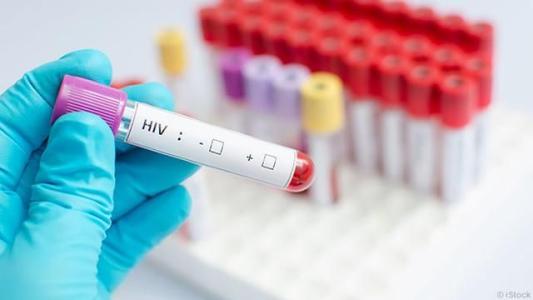 hiv是dna病毒吗，如何检测？