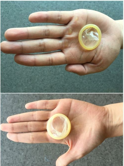 避孕套一定能防止艾滋病吗：正确使用