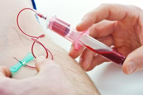 艾滋病抽血检测