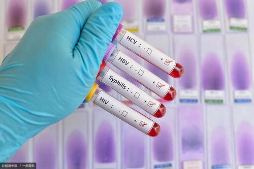 艾滋病抽血检测试管