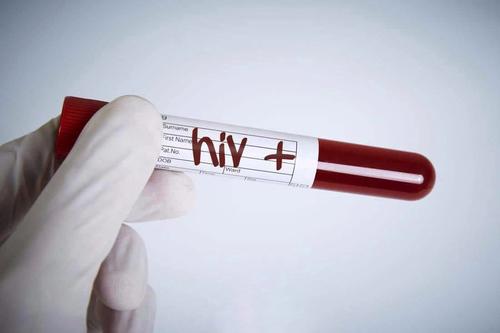 提取出的艾滋病DNA能传染人么：艾滋病在空气中容易死亡