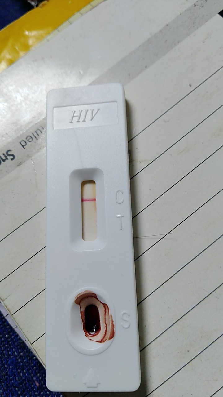 hiv检测试纸一条杠图片