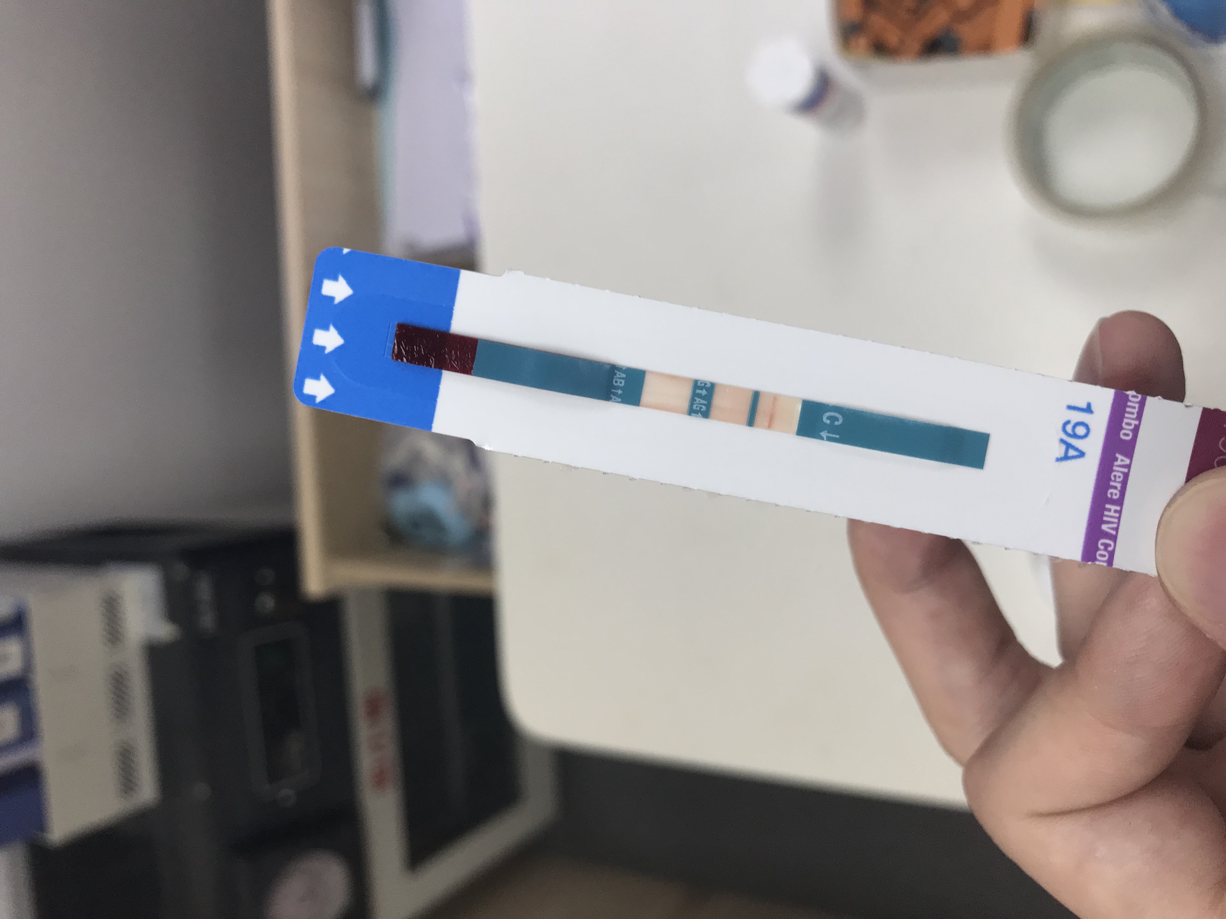 艾滋病42天检测准确吗