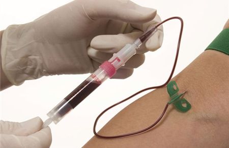 抽血化验检测hiv