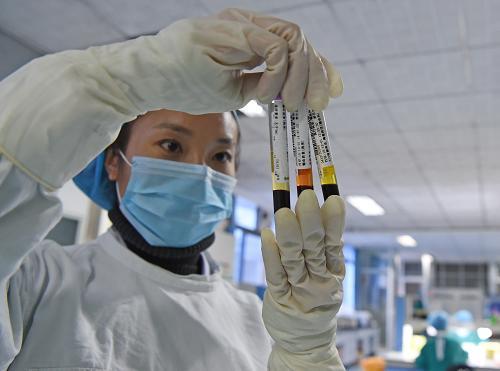 艾滋高危7天DNA检查可靠吗：检测结果可以作为诊断依据