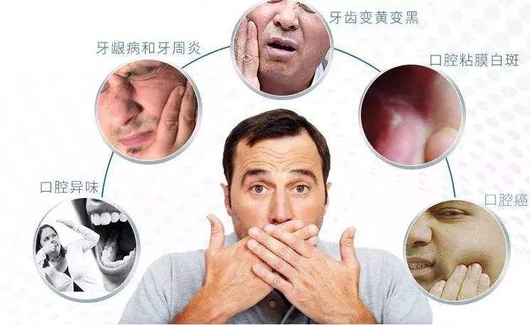 艾滋病口腔溃疡传染吗