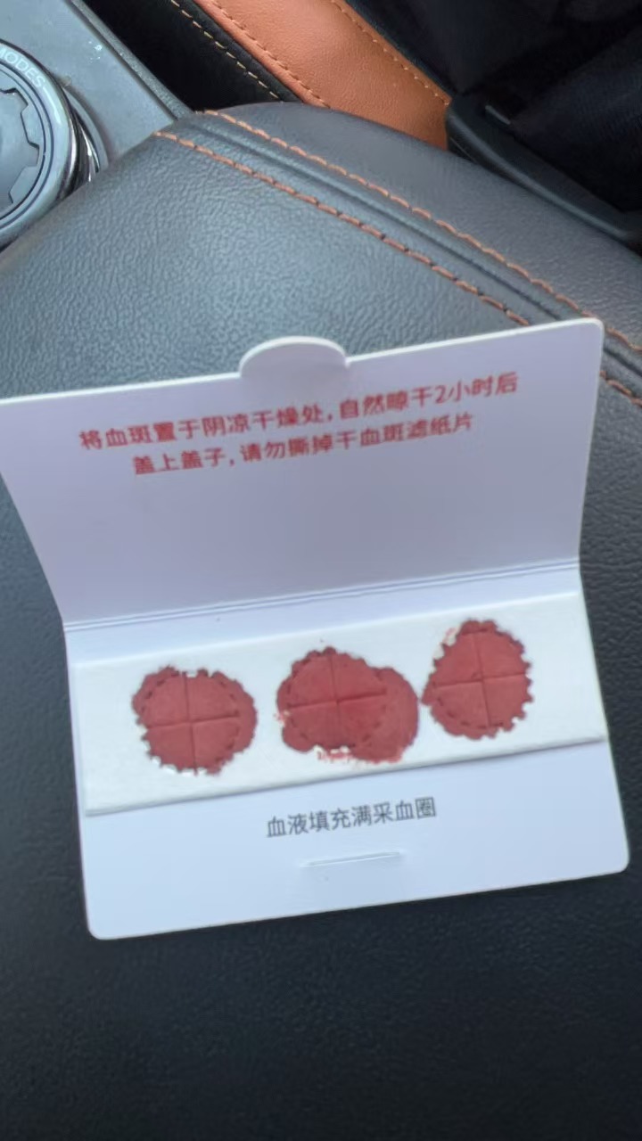 艾滋病传播方式有几种