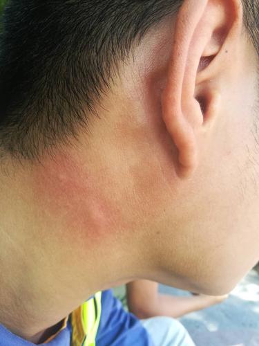 艾滋病经历