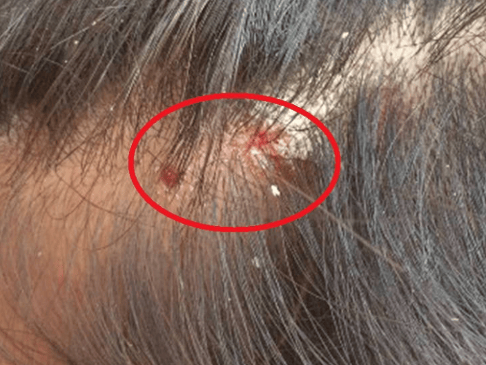 艾滋病是怎样传播的