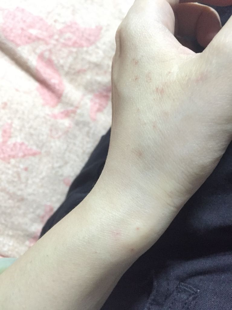 合肥艾滋免费检测点