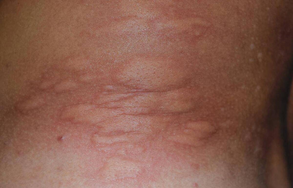 北京血站是用核酸检测hiv吗