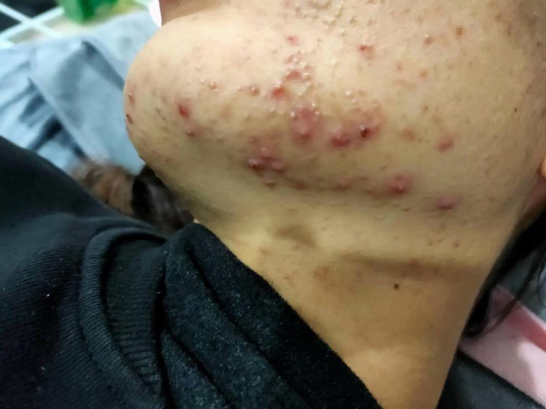 艾滋病能看出来吗
