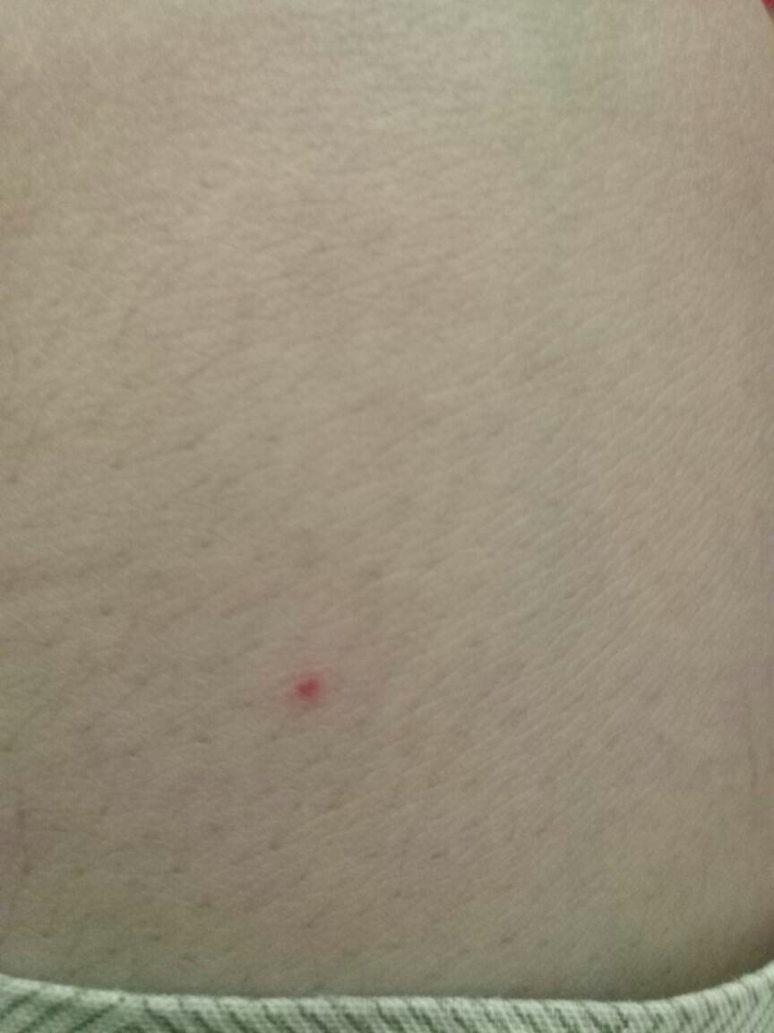 大连哪里能做HIV核酸检测