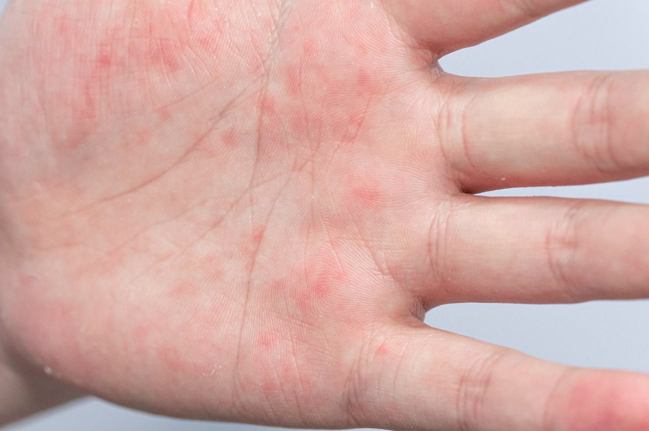 香港私人医院 hiv核酸检测