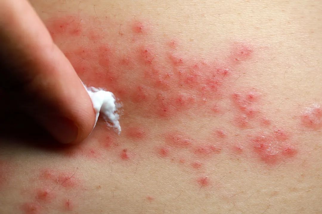 艾滋阻抗药