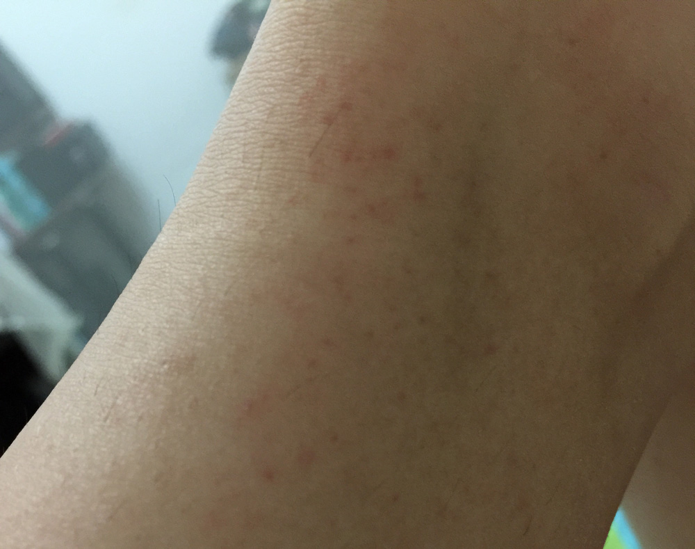 艾滋病多久出现症状