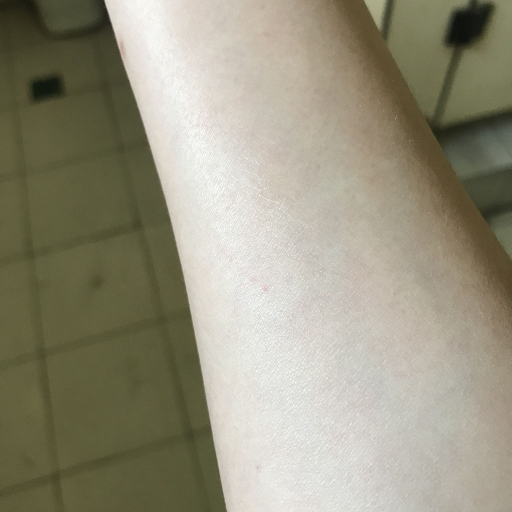 艾滋病感染者图片