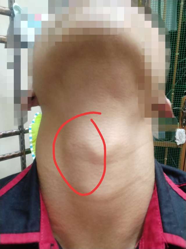 艾滋检测方法