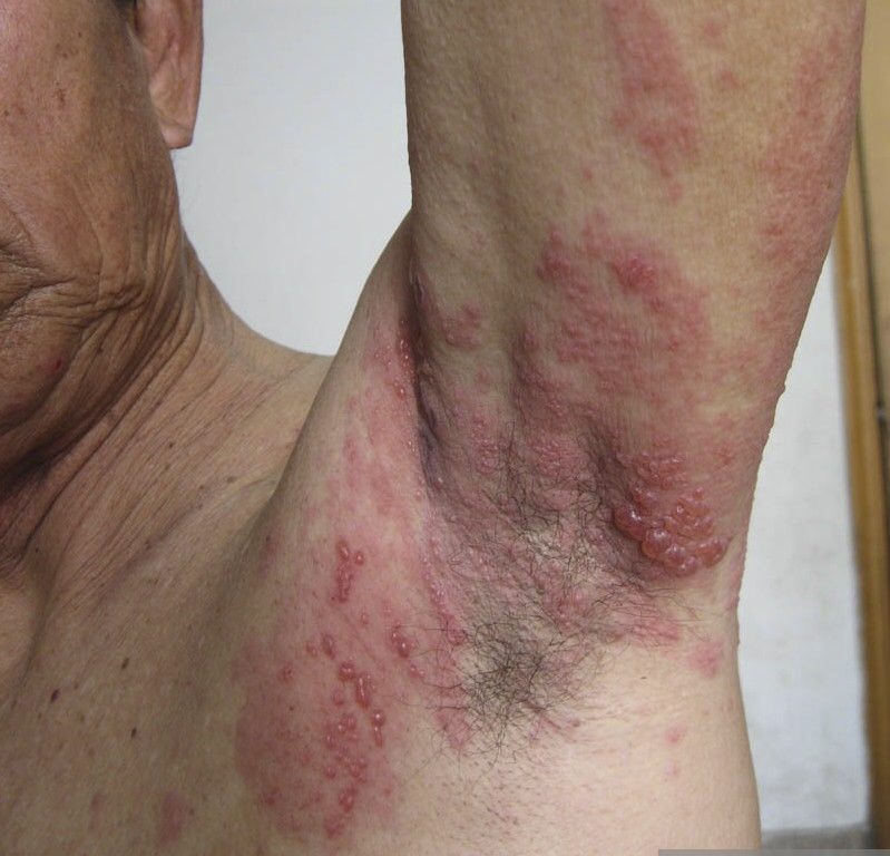 pcr实验室可以做hiv核酸检测吗
