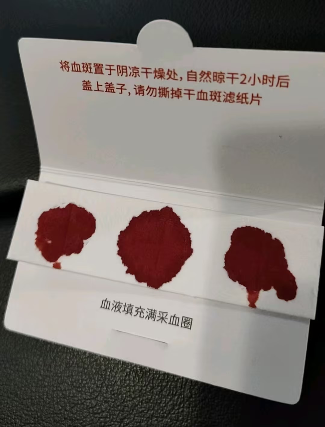 艾滋病核酸检测干血斑里病毒死了，还能检测