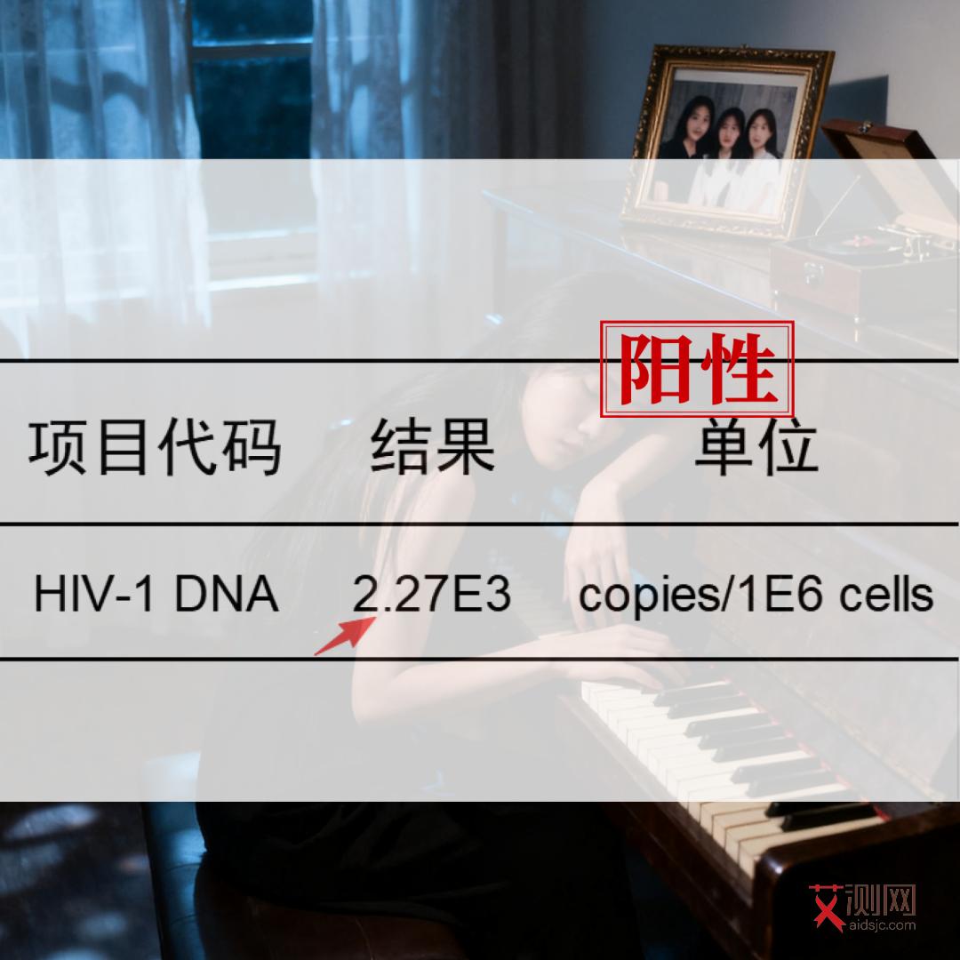 艾滋病白色念珠菌感染