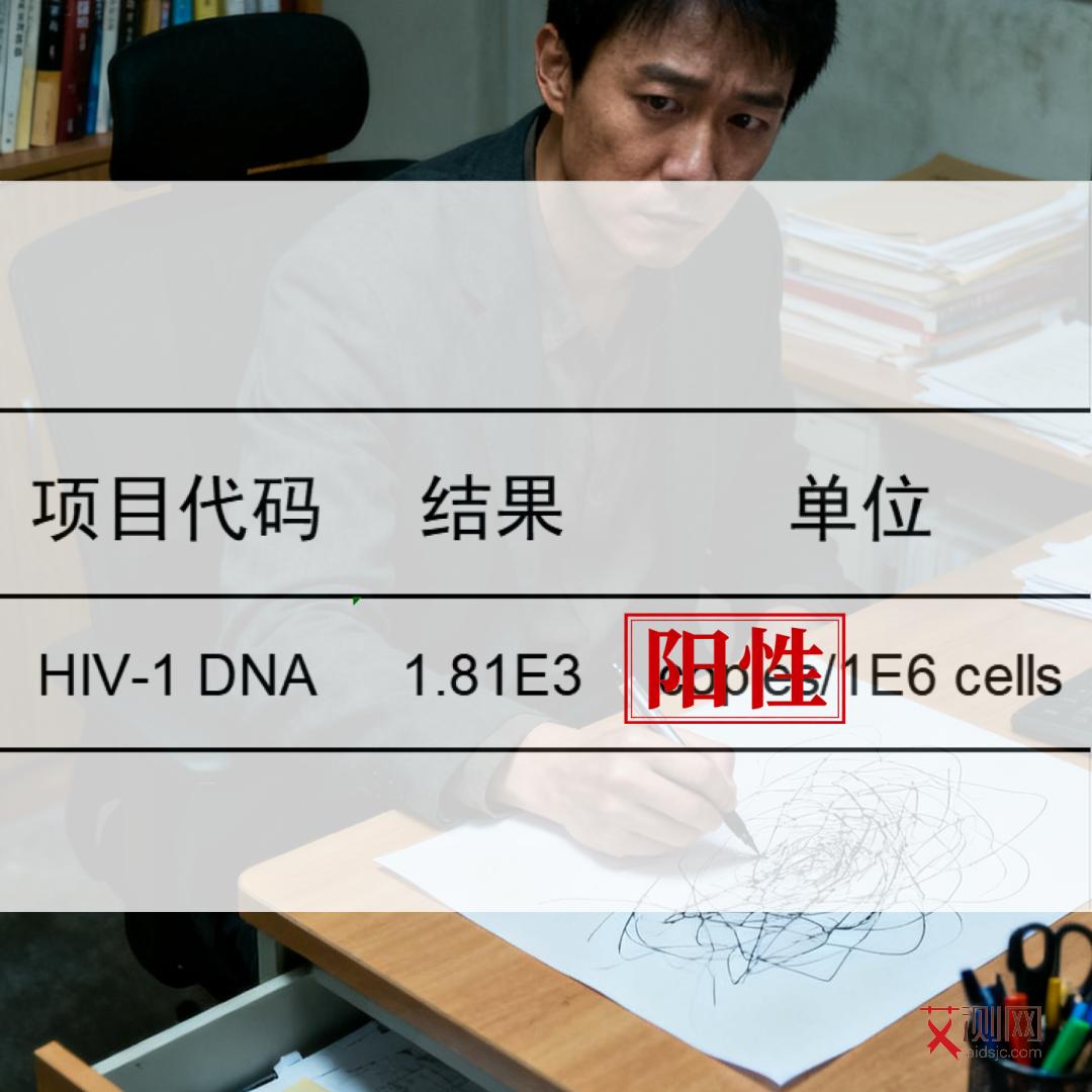 艾滋病红疹几天长满全身