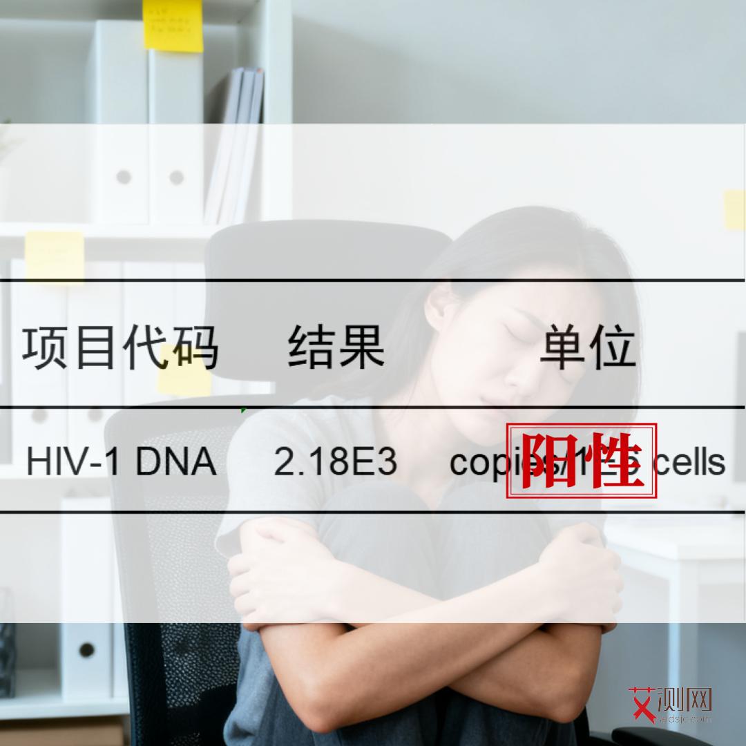 补牙齿会不会传染艾滋病