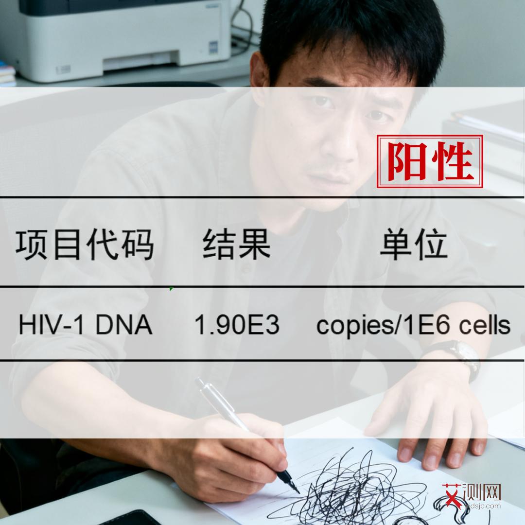 怎么检测是否有艾滋病病毒感染