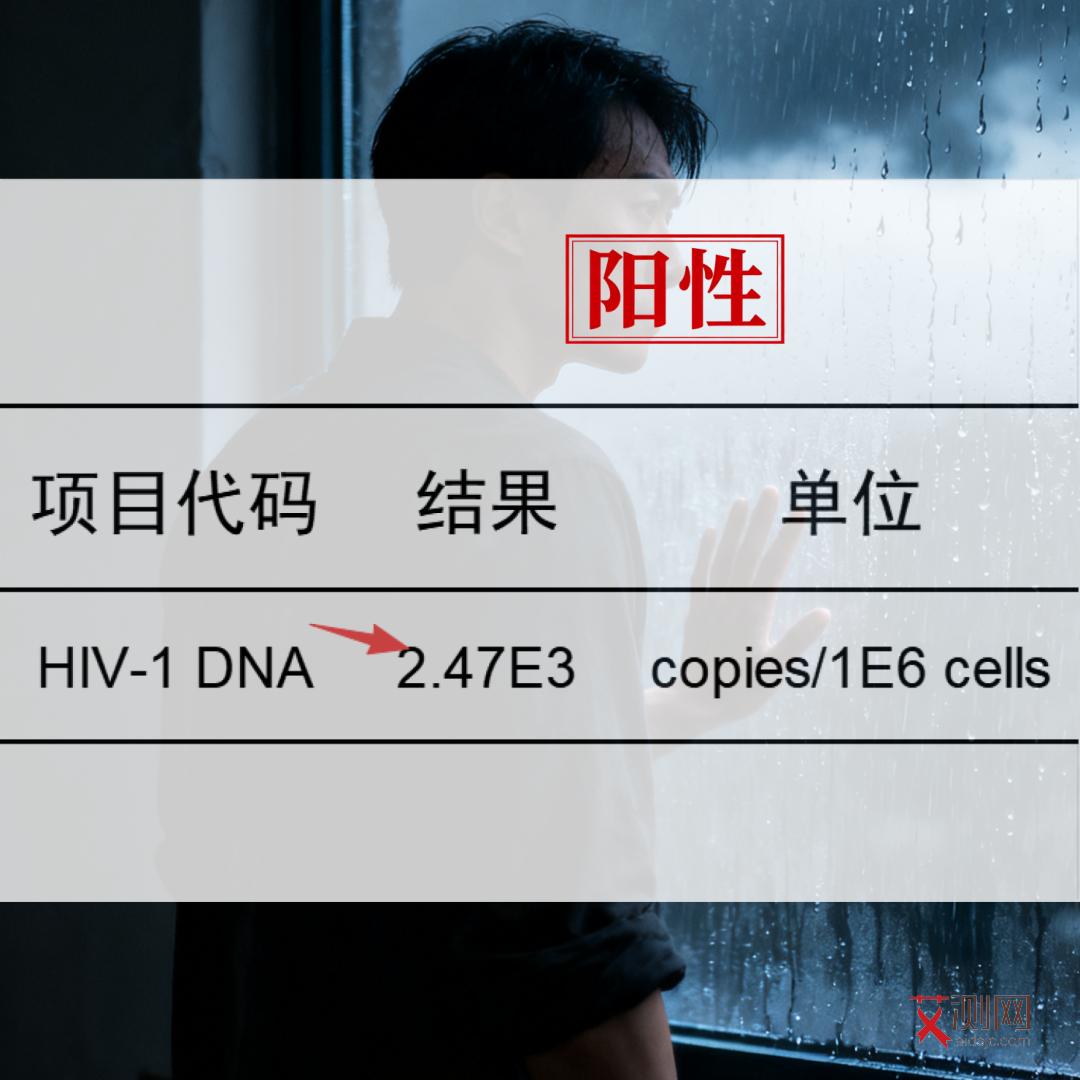 艾滋病有什么特别症状和感觉