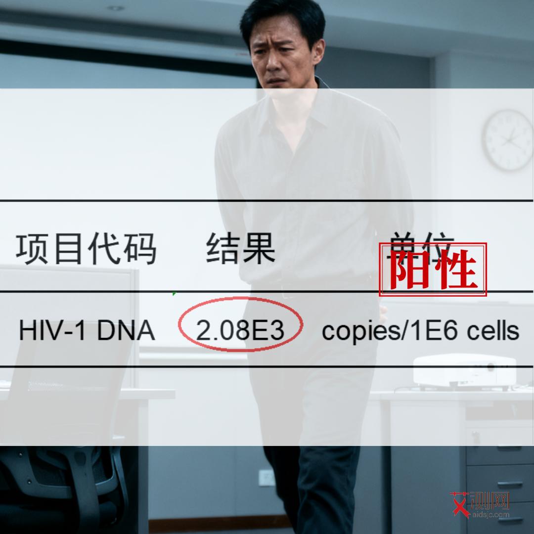 患上艾滋病是什么症状