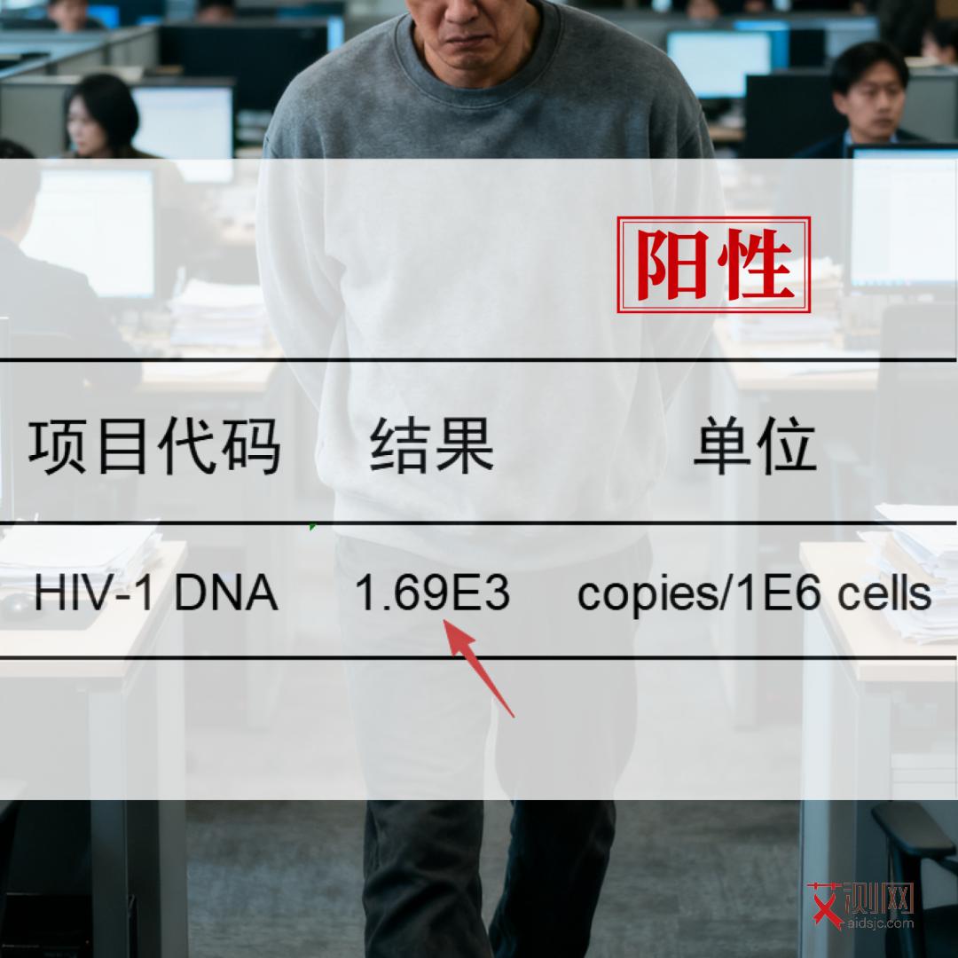 感染艾滋病男人会有什么特征呢