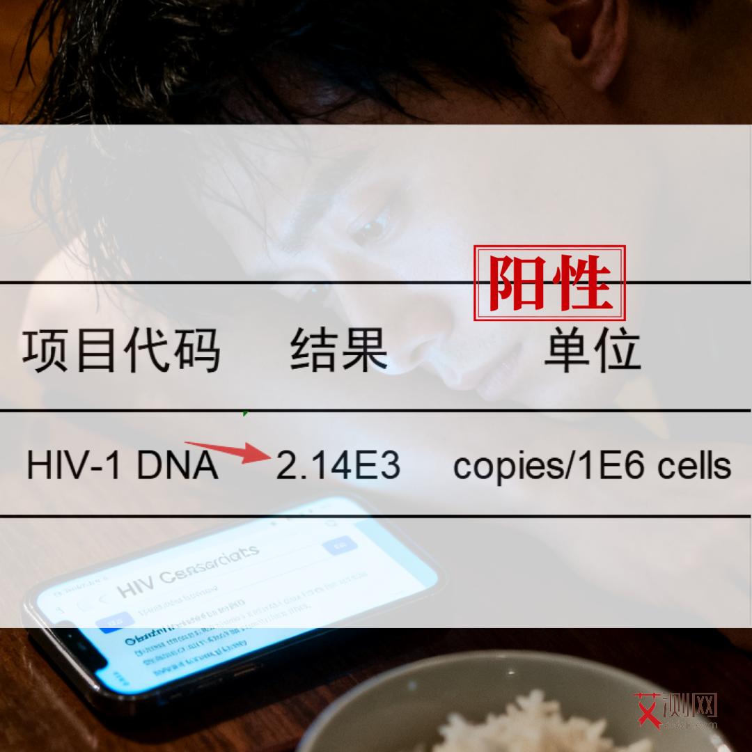 艾滋病女性下体臭不臭怎么判断