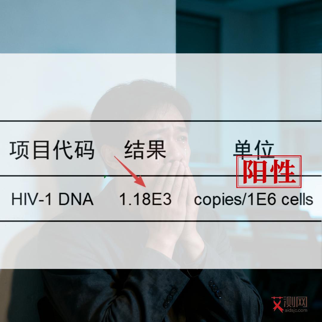 怎么判断自己有没有得艾滋病