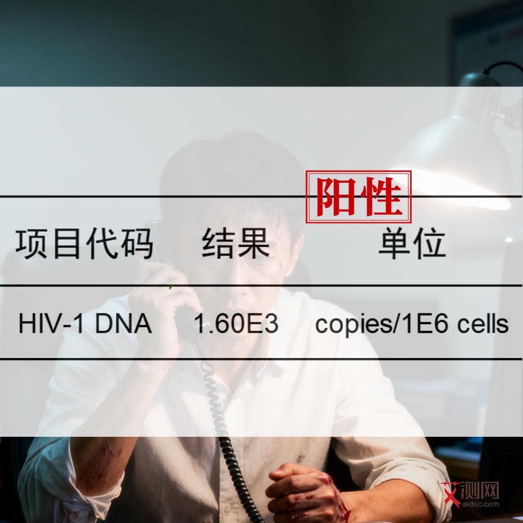 女性艾滋病患者特征有哪些图片和症状