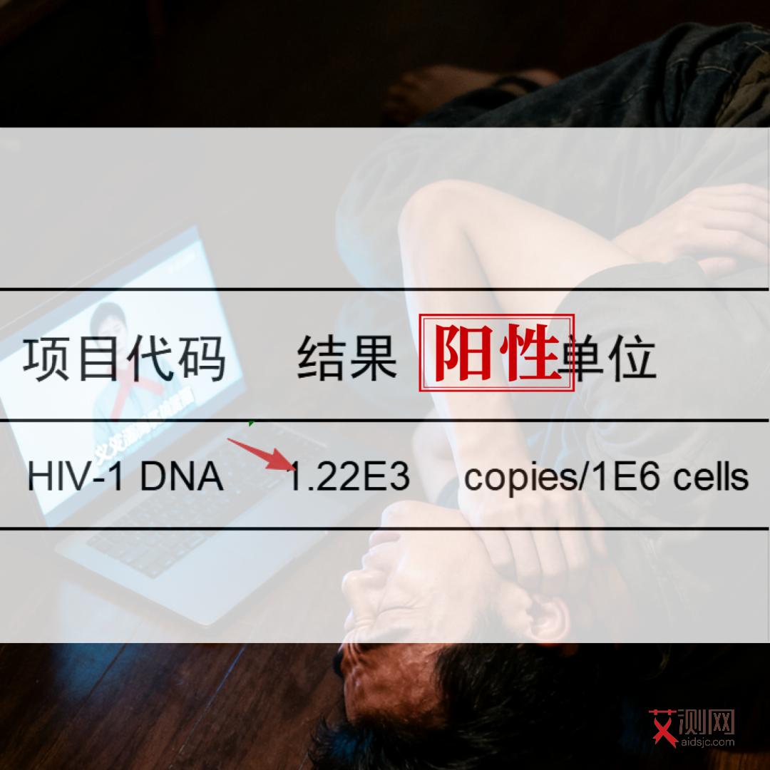 艾滋病症状特点有哪些图片男性女性