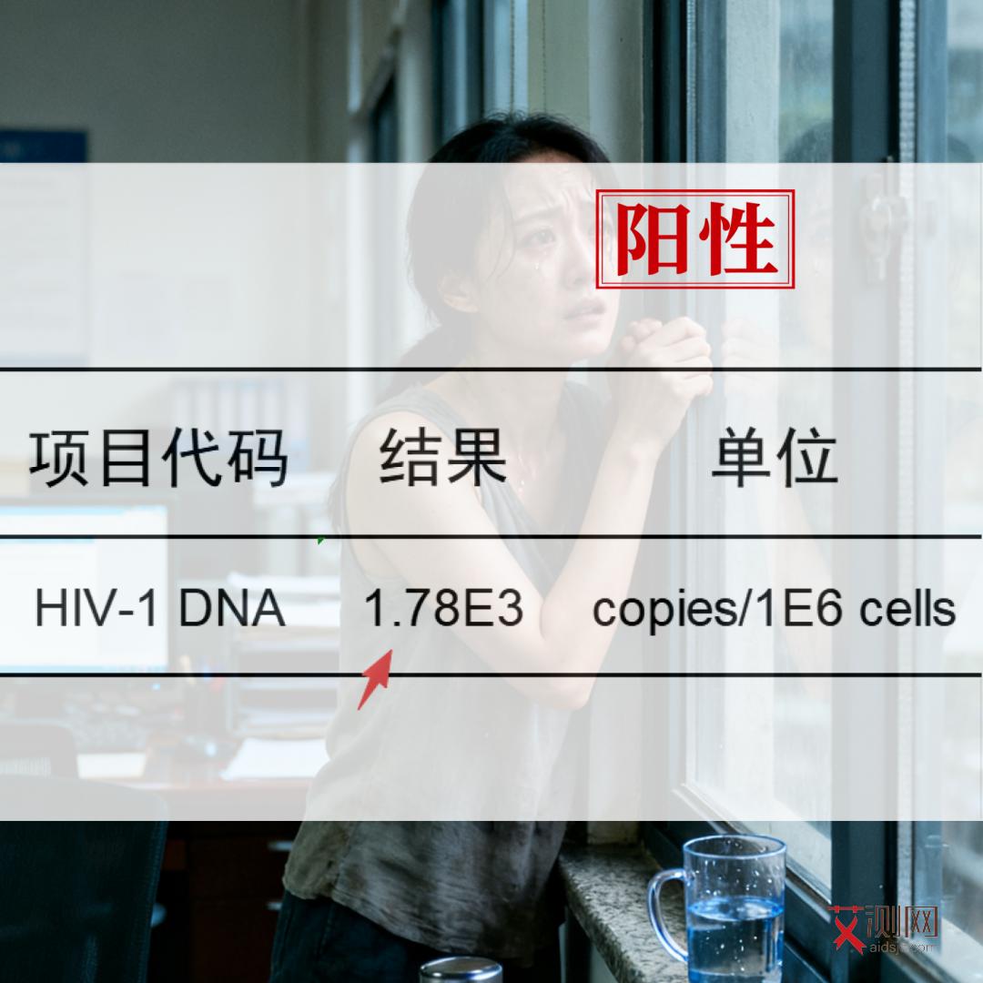 艾滋病的皮疹的症状是什么