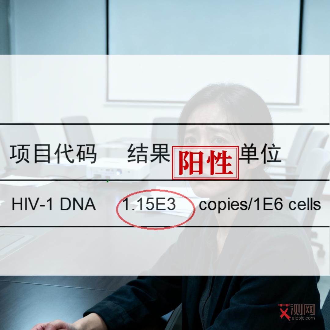 艾滋病艾滋病期试纸能检测吗