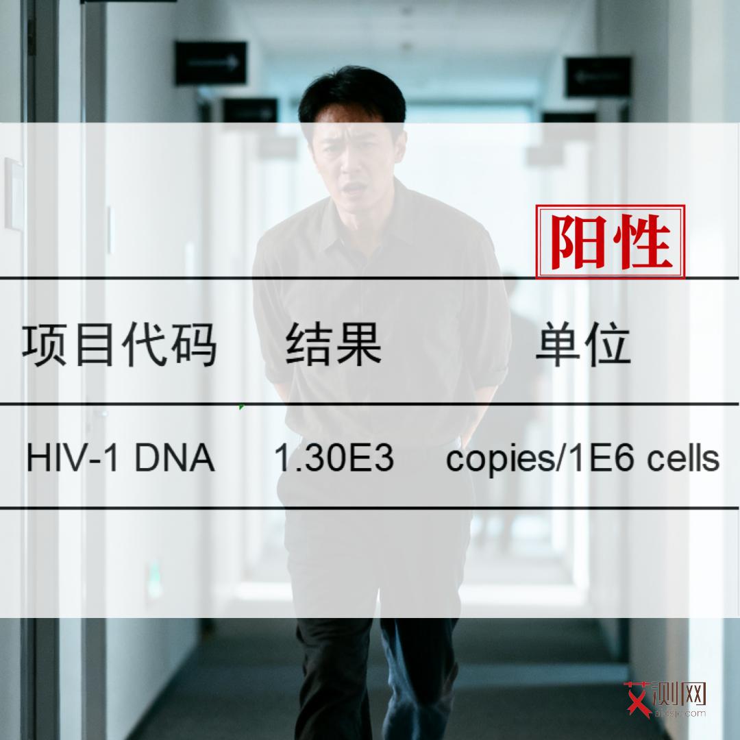 女艾滋病症状图片大全集高清