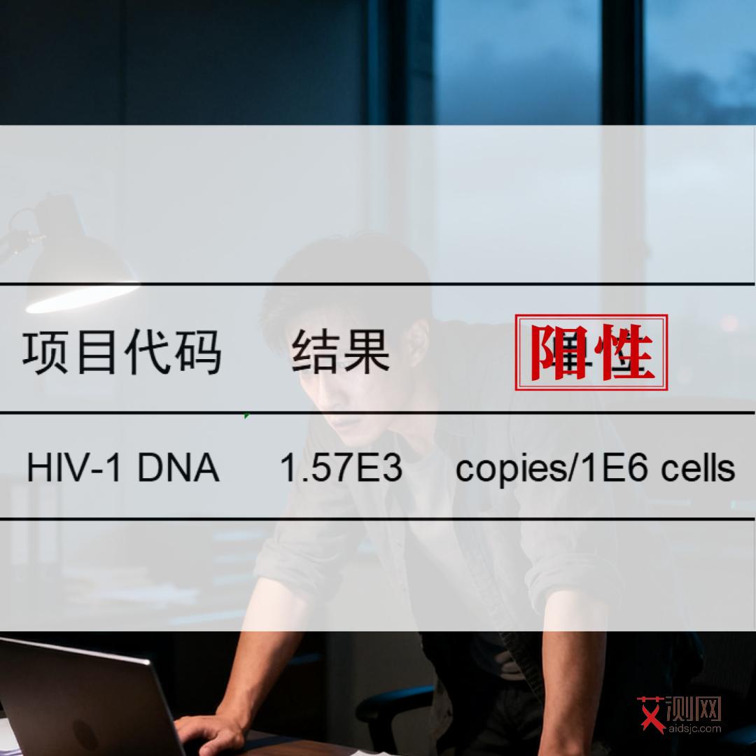 怎么检查自己有没有艾滋病和梅毒
