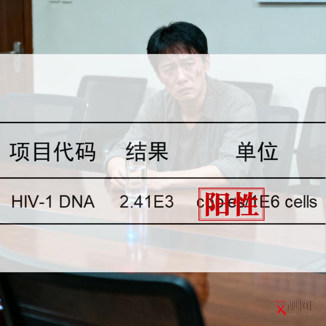 艾滋病征兆是什么表现呢