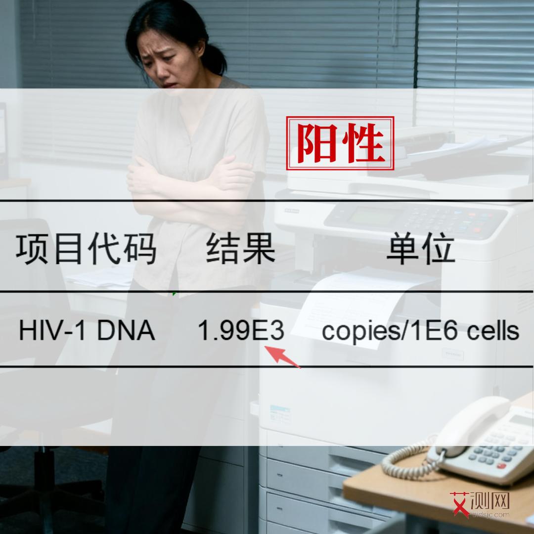 艾滋病的症状都有什么表现和症状女性吃什么药